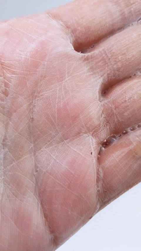Rubbing soap on hand quickly. Close up view of hand turning white Vídeos de archivo 334874752