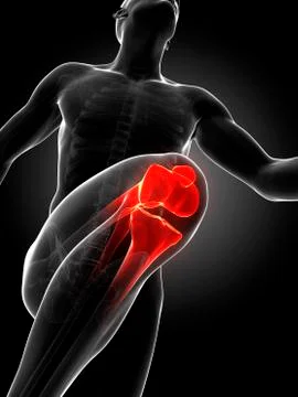 Runner's knee joint, artwork Stock Illustration