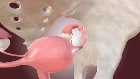 Ruptured Fallopian Tube Vídeos de archivo 245278937