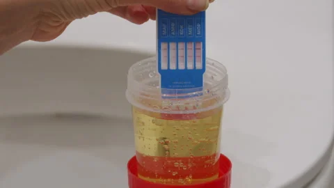 Russian multi panel drug screening test. Urine drug screen rapid test ten drugs. Stock Footage 295165947