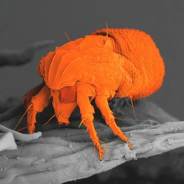 Rust mite observed in a scanning electron microscope Stock Photos