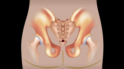 Sacroilliac joint injection Vídeos de archivo 37929840