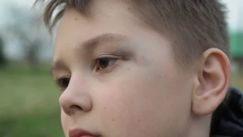 A sad boy with a black eye.the aftermath of the fight Stock Footage 153931906