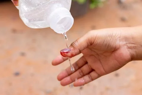 The saline solution is poured over the human finger with black nails, bruised Foto stock