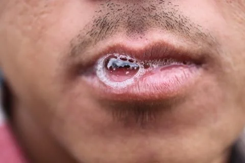 Saliva Stock Photos