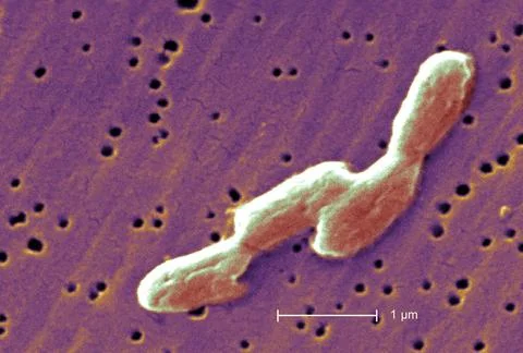  Salmonella infantis This scanning electron micrograph (SEM) depicts four ... Stock Photos