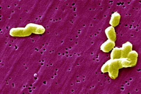  Salmonella infantis This scanning electron micrograph (SEM) depicts a num... Stock Photos