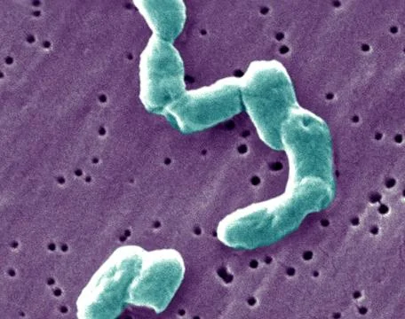  Salmonella infantis This scanning electron micrograph (SEM) depicts a num... Stock Photos