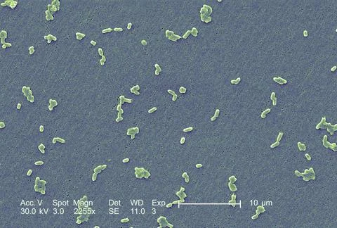  Salmonella infantis This scanning electron micrograph (SEM) depicts a num... Stock Photos