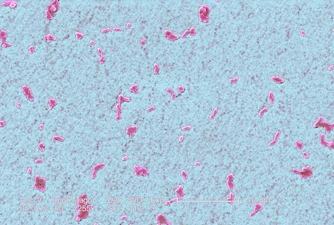  Salmonella infantis This scanning electron micrograph (SEM) depicts a num... Stock Photos
