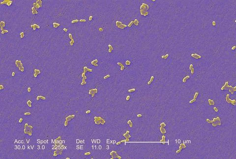  Salmonella infantis This scanning electron micrograph (SEM) depicts a num... Stock Photos