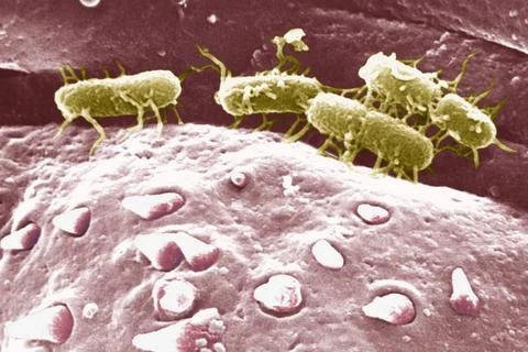  Salmonella typhi Scanning electron micrograph view of the cuticular surfa... Stock Photos