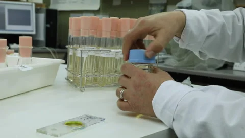 Sample agitated in the lab and micropipette Stock-Footage 145362370