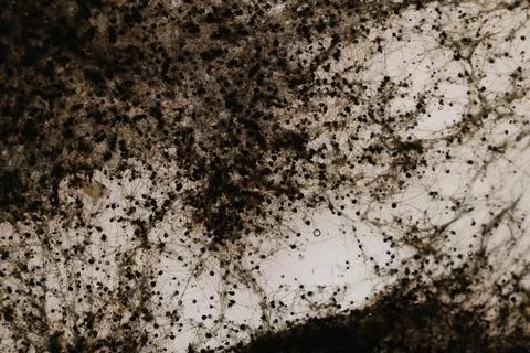 Sample of bacteria culture as background, macro view Foto stock