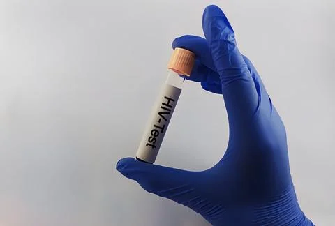 Sample blood collection tube with HIV test label in laboratory. Stock Photos