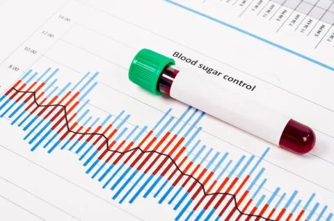 Sample blood for screening diabetic test in blood tube. 스톡 사진
