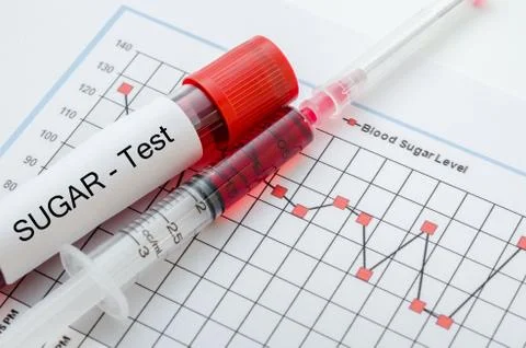 Sample blood for screening diabetic test. 스톡 사진