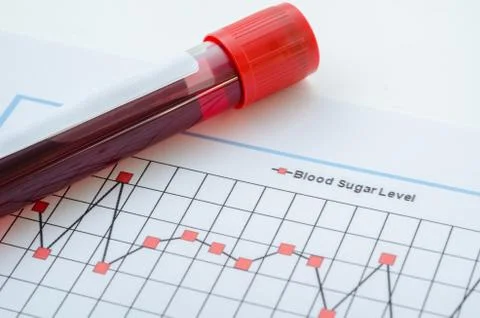 Sample blood for screening diabetic test. 스톡 사진