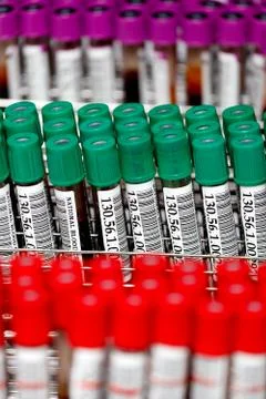 Sample blood tubes in lab?ratory Stock Photos