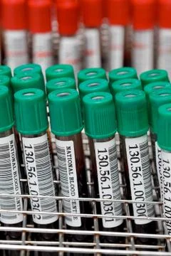 Sample blood tubes in lab?ratory Stock Photos
