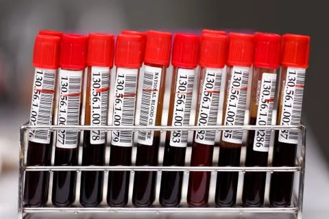 Sample blood tubes in lab?ratory Foto stock