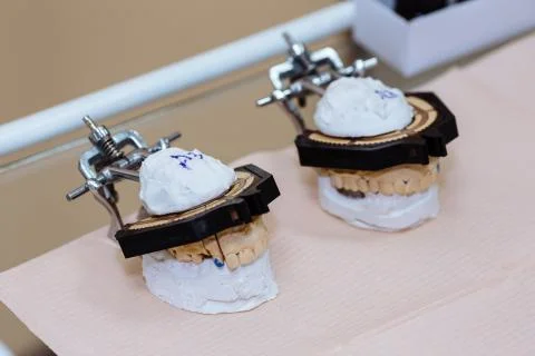 Sample jawbone. Equipment of dentist, tools, medical instruments. Healthy Stock Photos