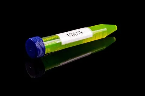 Sample liquid in the test tube with text VIRUS isolated on the black backgrou Stock Photos