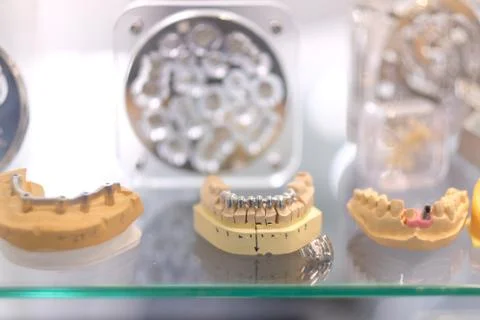 Samples of tooth crowns and implants for prosthetics at the dental exhibition Stock Photos