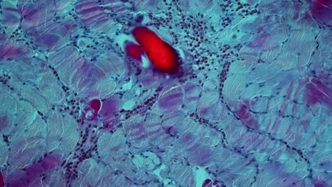 Sarcocyst parasites in bovine tissue when magnified Video stock 343130376