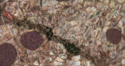 Sarcocyst parasites in monkey tissue when magnified Video stock 140389245