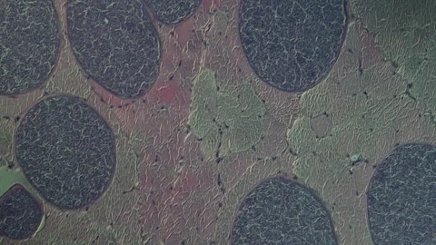 Sarcocyst parasites in monkey tissue when magnified Video stock 343130402