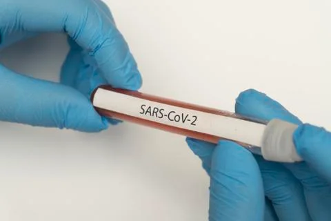 Sars Cov 2 Bloodtest Stock Photos