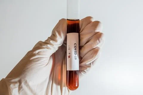 SARS-CoV-2 Stock Photos