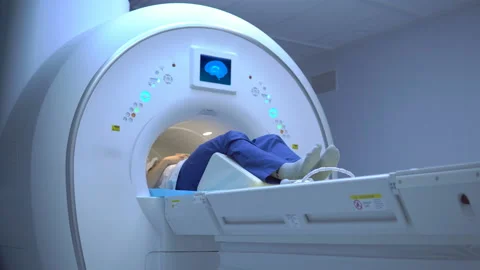 Scan of the human brain using a computer tomograph Video stock 104175984