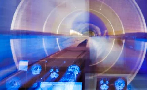 Scanner brain x-ray blur Stock Photos