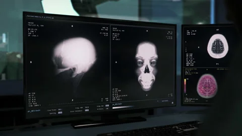 Scanner inspecting the brain of the sick patient for scientific research Stock Footage 218621383