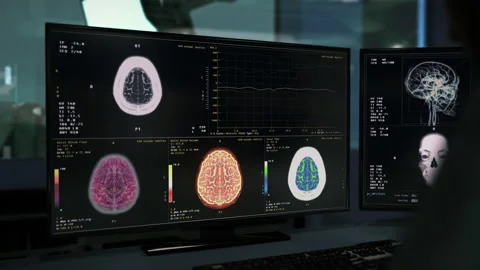 Scanner performs diagnostic procedure on the patients damaged brain organ Vídeo Stock 219503470