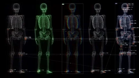 Scanning and tracking of the human skeleton in the matrix. Stock Footage 318586655