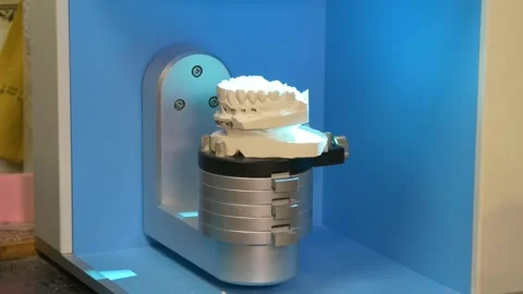 Scanning of casts on a 3D scanner for the manufacture of dentures. Stockbeeldmateriaal 256580321