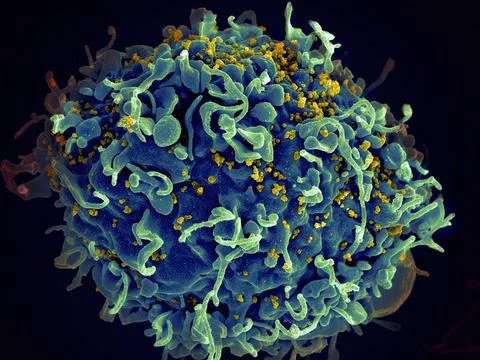  Scanning electron micrograph of a human H9 T cell (blue/green) infected w... Stock Photos