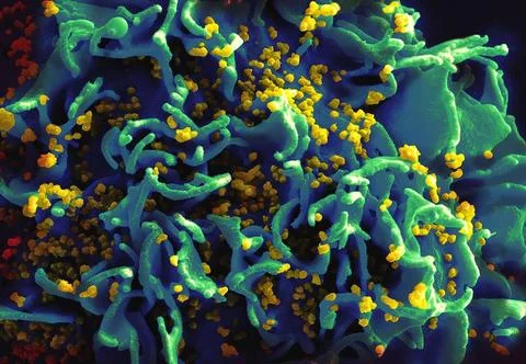  Scanning electron micrograph of a human H9 T cell (blue/green) infected w... Stock Photos