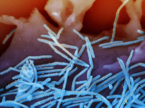  Scanning electron micrograph of human respiratory syncytial virus (RSV) v... Stock Photos