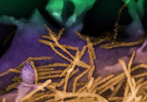  Scanning electron micrograph of human respiratory syncytial virus (RSV), ... Stock Photos