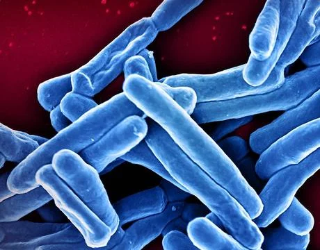  Scanning electron micrograph of Mycobacterium tuberculosis particles (col... Stock Photos