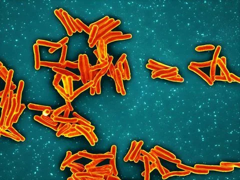  Scanning electron micrograph of Mycobacterium tuberculosis particles (col... Stock Photos