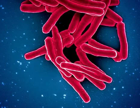  Scanning electron micrograph of Mycobacterium tuberculosis particles (col... Stock Photos