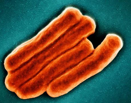  Scanning electron micrograph of Mycobacterium tuberculosis particles (col... Stock Photos