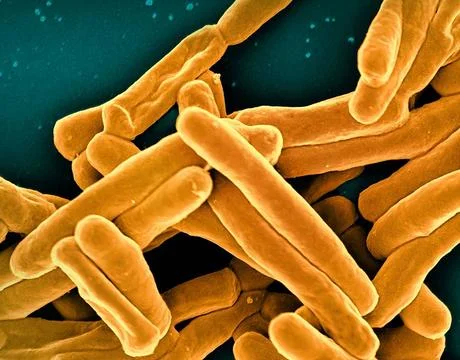  Scanning electron micrograph of Mycobacterium tuberculosis particles (col... Stock Photos
