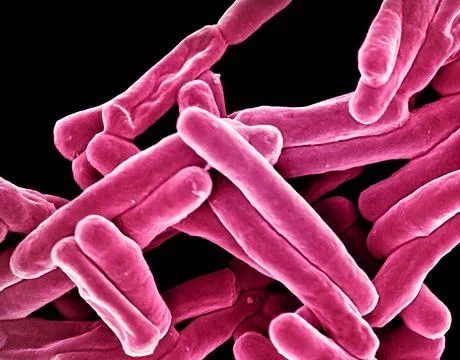  Scanning electron micrograph of Mycobacterium tuberculosis particles (col... Stock Photos