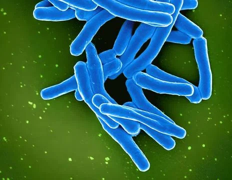  Scanning electron micrograph of Mycobacterium tuberculosis particles (col... Stock Photos
